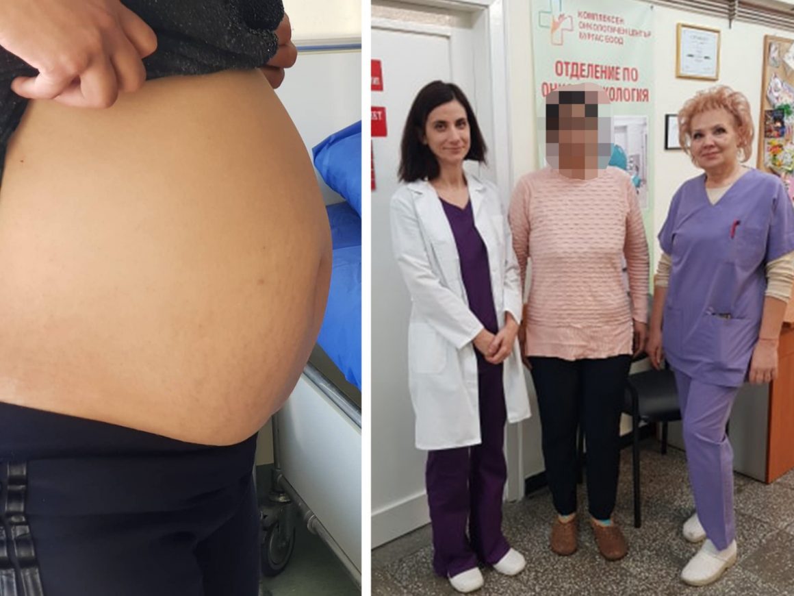 Екип  на отделението по онкогинекология към КОЦ-Бургас отстраниха успешно 8-килограмов тумор от матката на 36-годишна жена